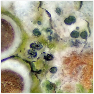 Skyttea lecanorae