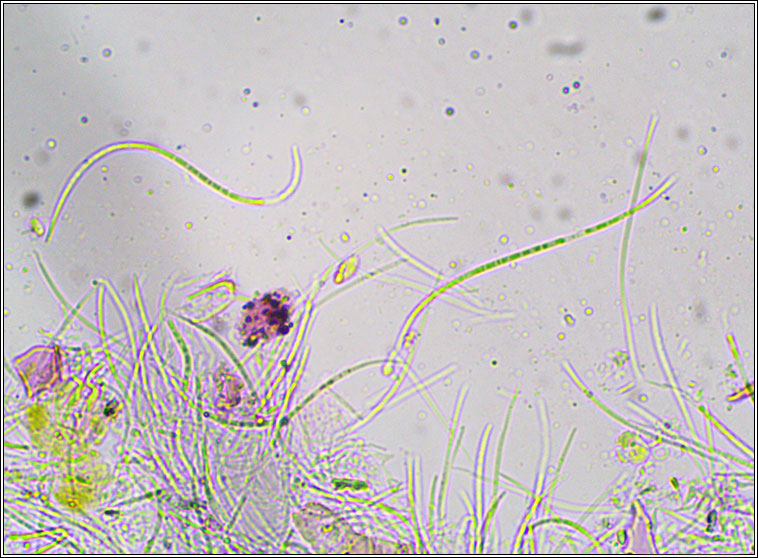 Celothelium ischnobelum
