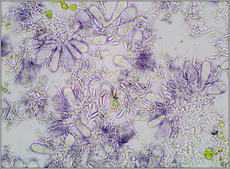 Micarea nitschkeana