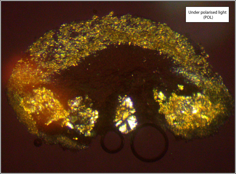 Lecanora pseudargentata, POL